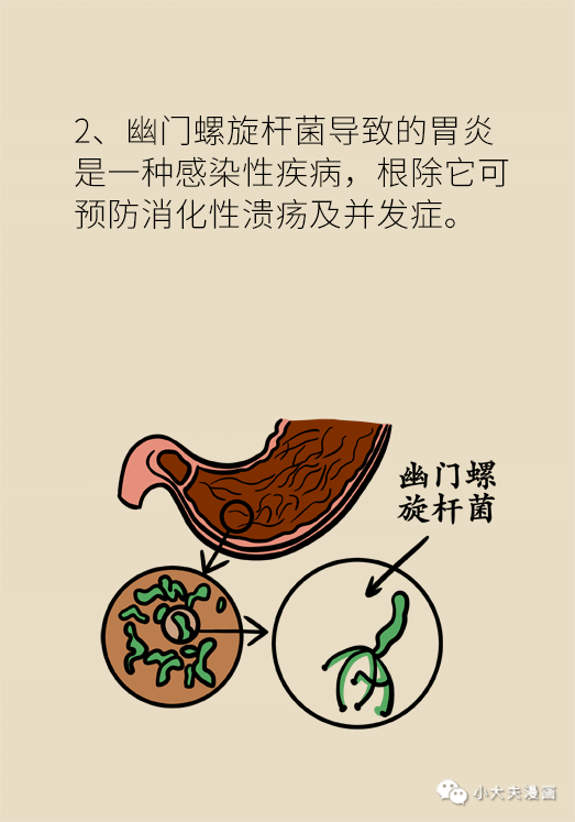 幽門螺旋桿菌新療法,幽門螺旋桿菌新療法論述